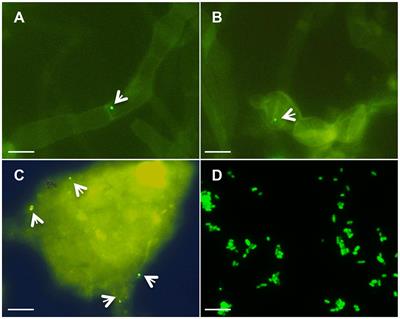 The Abundance of Endofungal Bacterium Rhizobium radiobacter (syn. Agrobacterium tumefaciens) Increases in Its Fungal Host Piriformospora indica during the Tripartite Sebacinalean Symbiosis with Higher Plants